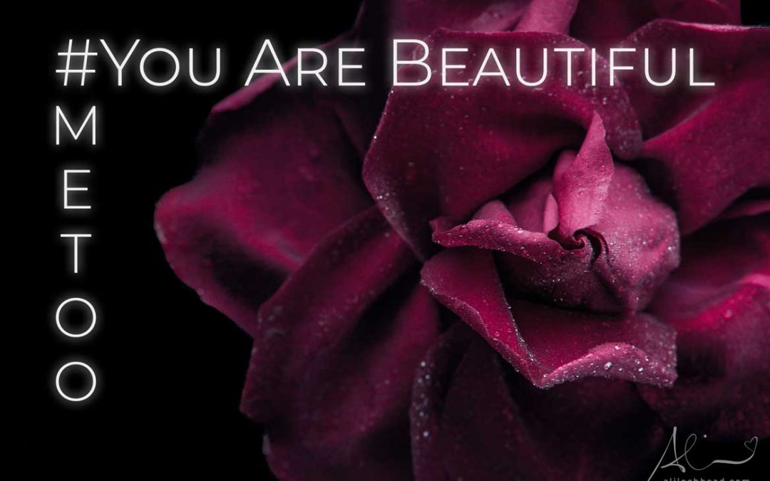 You Are Beautiful #MeToo
